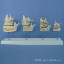 Human Tooth Growth Process Anatomy Model for Teaching (R080102)